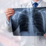 Lung Cancer Awareness Week 2020 _ Banyan Treatment Center